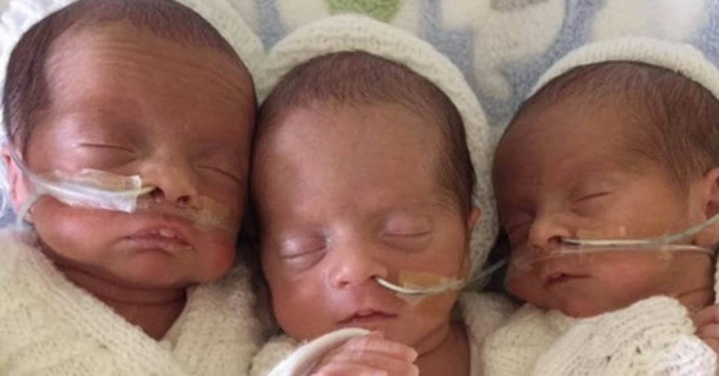 Mom Rushes To The Hospital But When She Delivers Triplets The Doctors Are In Awe 4352