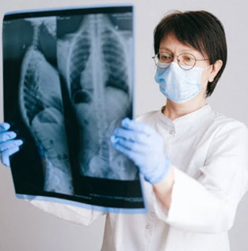 Doctors Stunned When Woman’s ‘UTI’ Turns Out to Be Glass Tumbler Stuck